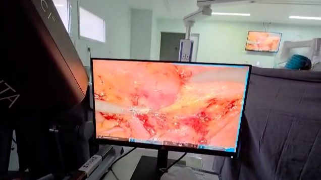 Cirurgia_robótica_custa_caro?_O_que_realmente_pesa_nessa_decisão