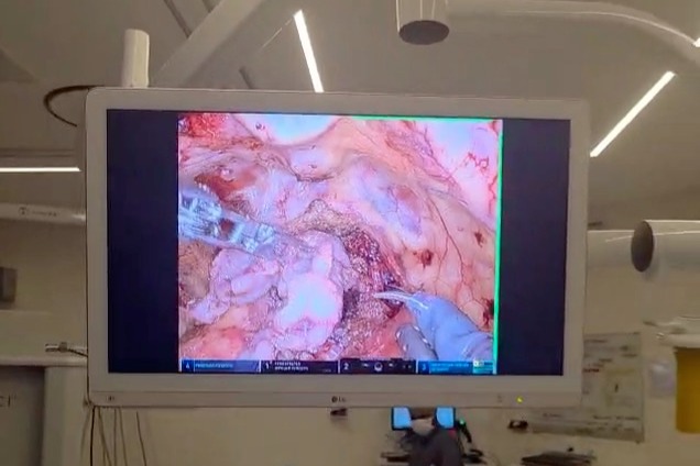 Prostatectomia: entenda as indicações, como funciona o procedimento e a recuperação Prostatectomia:_entenda_as_indicações,_como_funciona_o_procedimento_e_a_recuperação